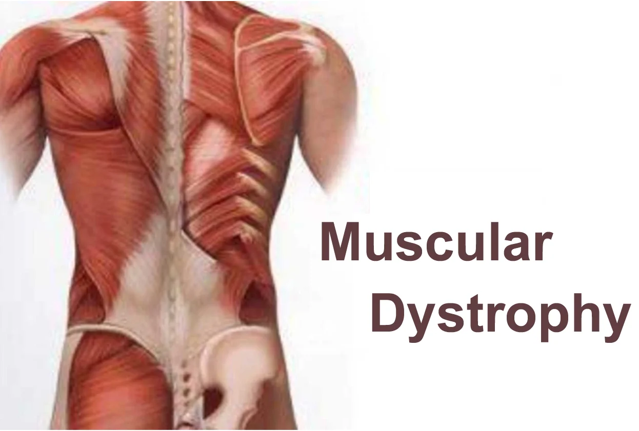 Muscular Weakness